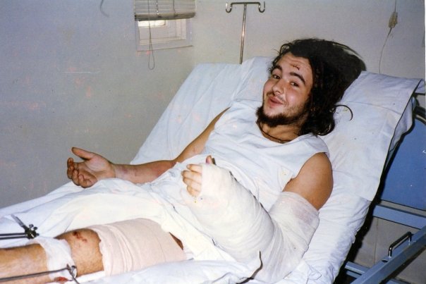 Hilton in recovery at Agra.