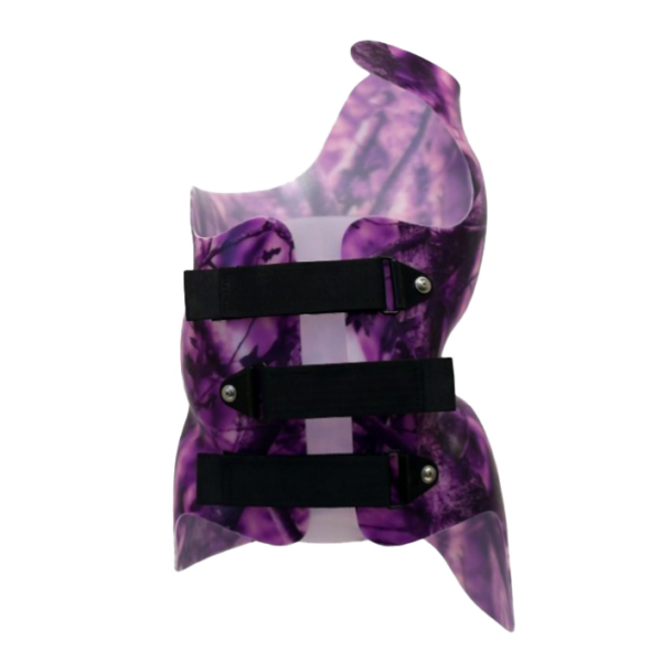 SCT 3D Cheneau (Style) Scoliosis Brace